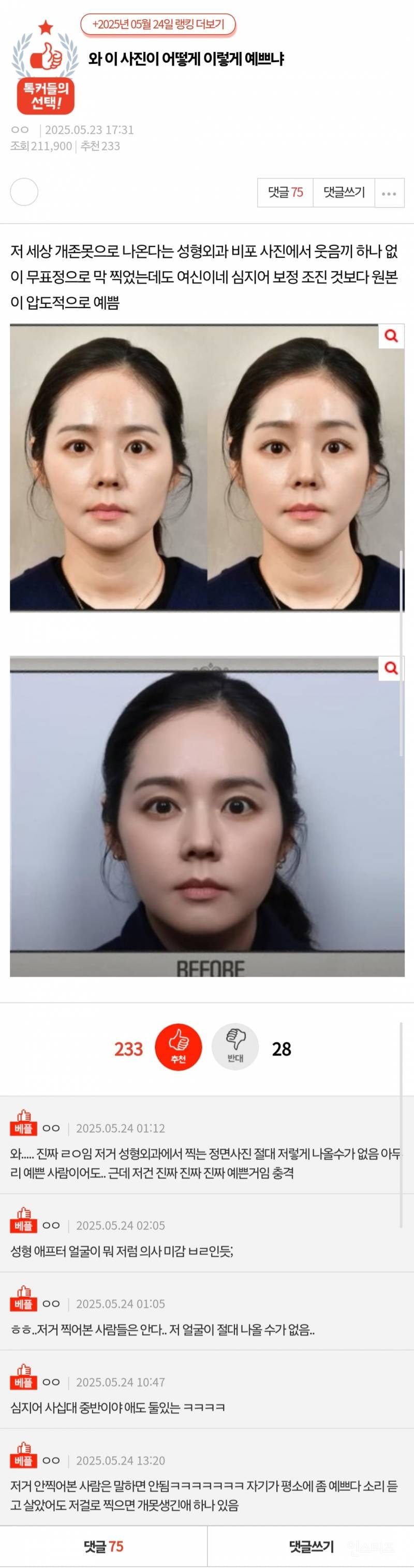 진짜 예쁘게 나오기 힘들다는 성형외과 정면 사진.jpg | 인스티즈