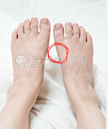 [잡담] 크림에서 신발 샀는데 이거 불량품 맞지?? | 인스티즈