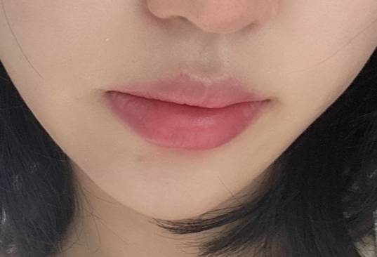 [잡담] 입술필러함 ㅜ 더할걸 | 인스티즈