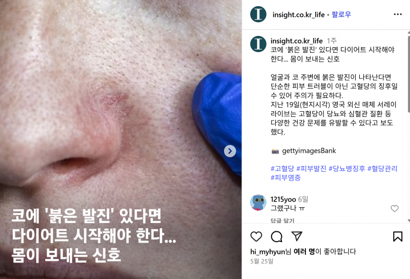 [잡담] 코옆 붉으면 고혈당일 수도 있대 | 인스티즈