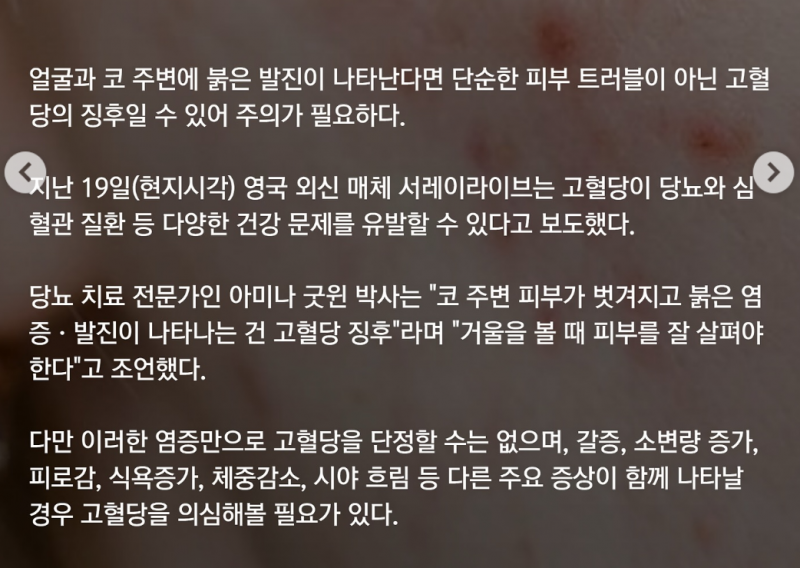 [잡담] 코옆 붉으면 고혈당일 수도 있대 | 인스티즈