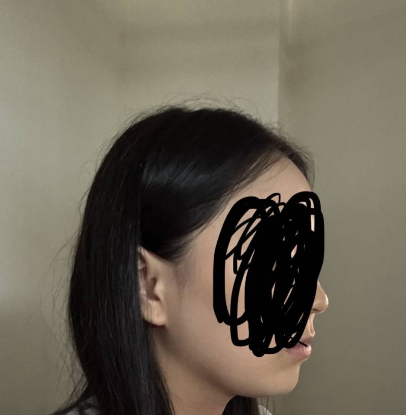 [잡담] 혹시 턱에 살 조금이라도 찐거같아? 아나몀 빠진거같아? 아니몀 똑같아? 솔직하게 봐주라! | 인스티즈