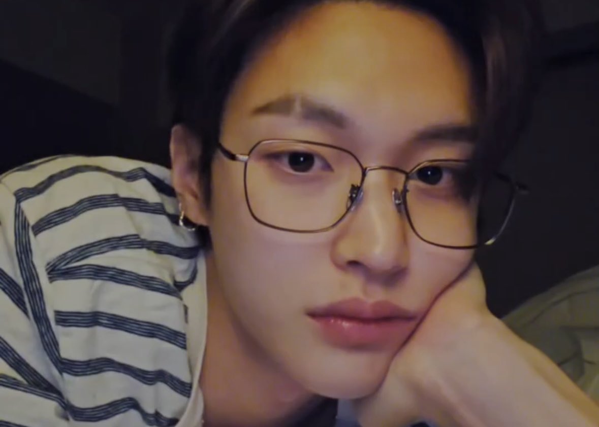 [잡담] 원빈 얼굴... 눈썹 흉터.... | 인스티즈