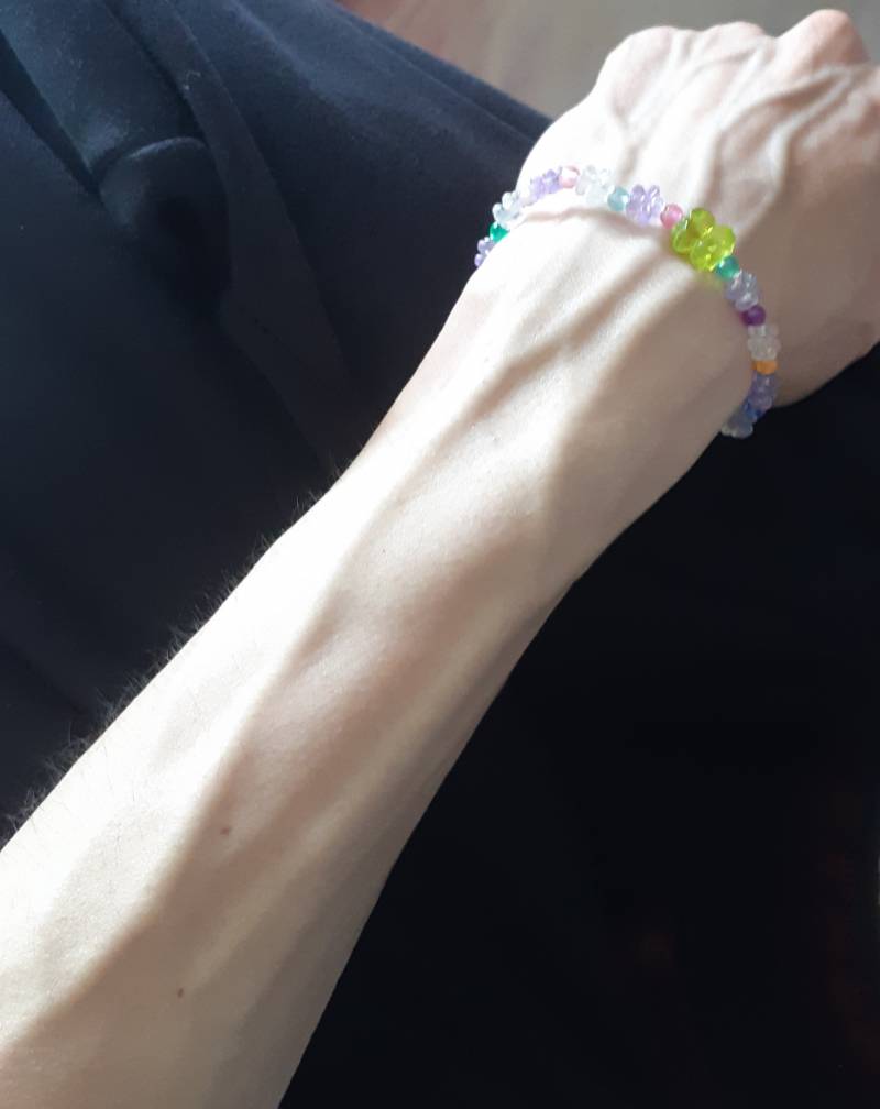 [잡담] 앉아서 팔 이러고 있으면 다들 이렇게 되나? | 인스티즈