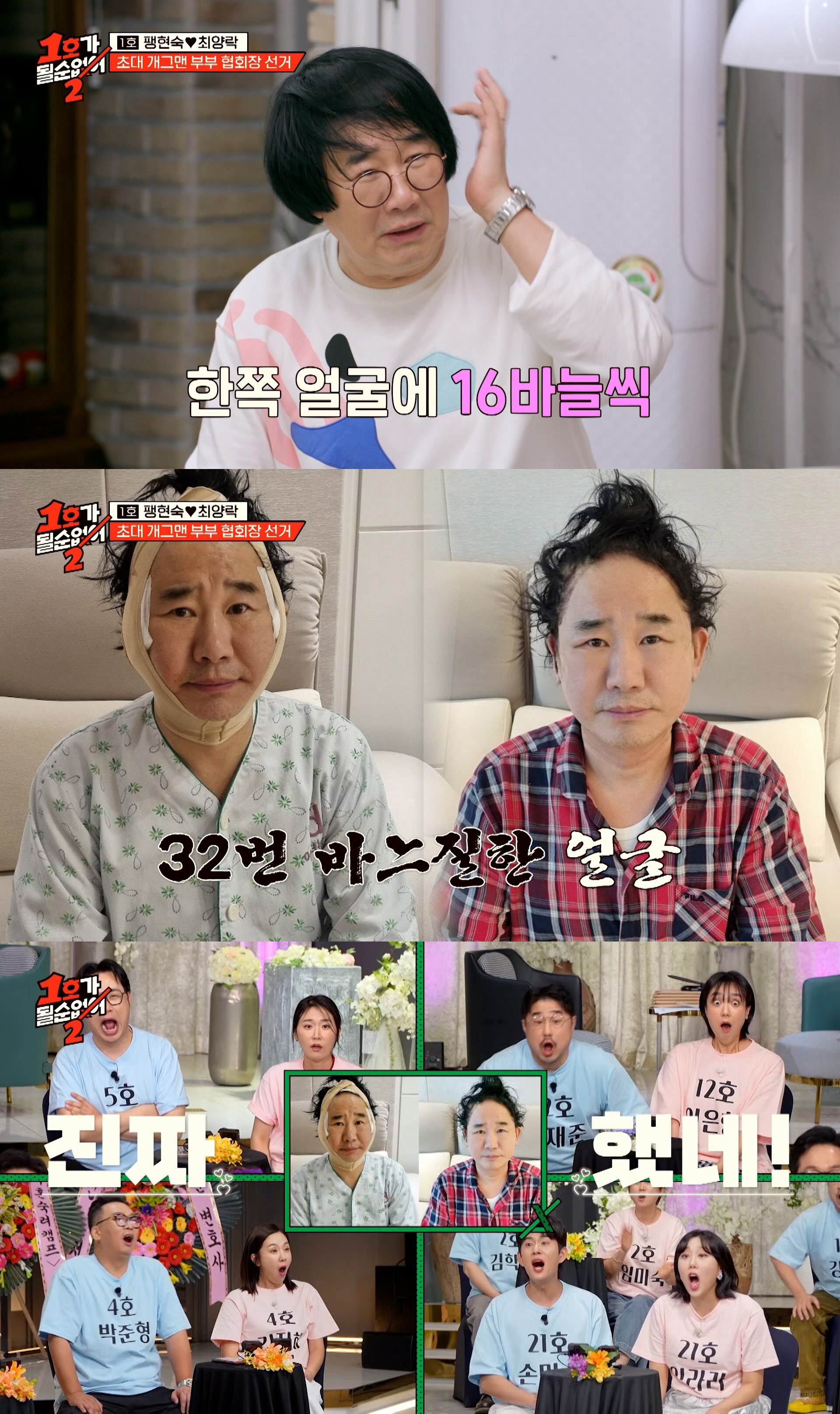 알고 보니 성형 중독이라는 의외의 개그맨 | 인스티즈