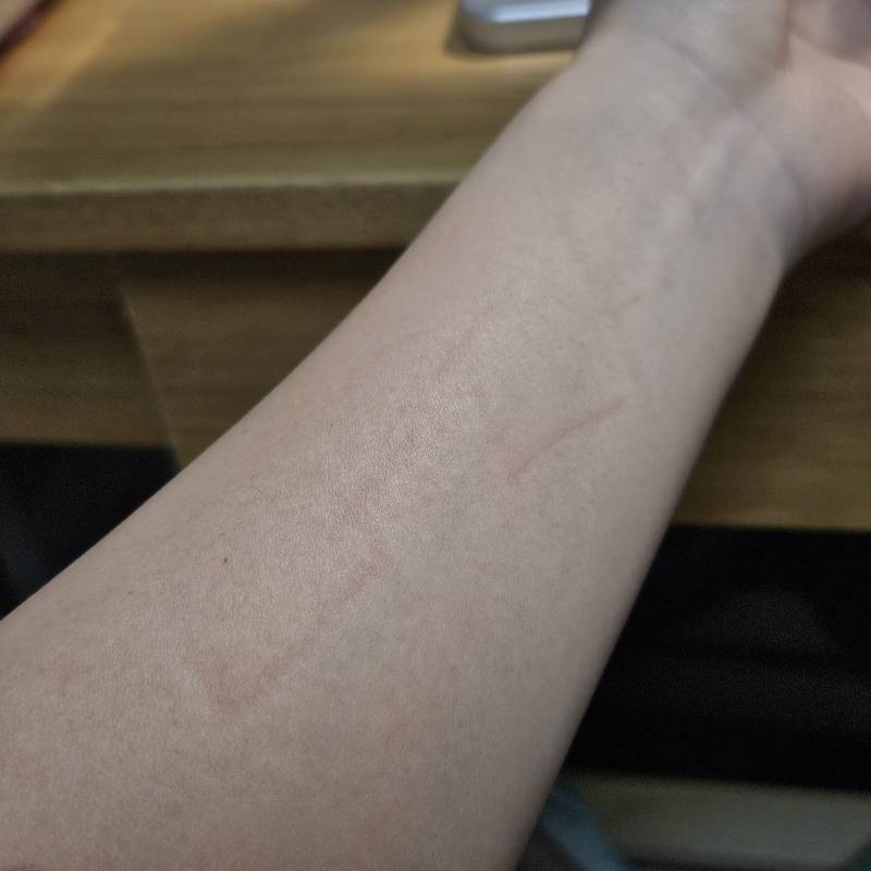[잡담] 아놔 묘기증 생김 | 인스티즈
