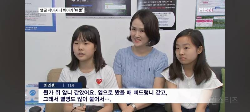 얼굴이 작아져서 치아가 기형으로 나고있다는 요즘 애들.jpg | 인스티즈
