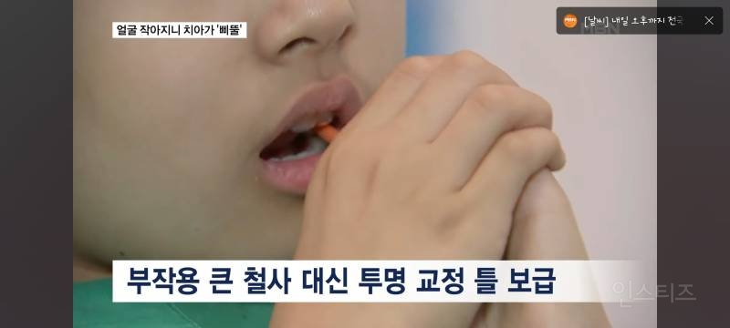 얼굴이 작아져서 치아가 기형으로 나고있다는 요즘 애들.jpg | 인스티즈