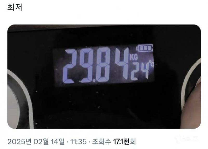 체중 29kg 이라는 거식증 20의 몸상태.jpg | 인스티즈