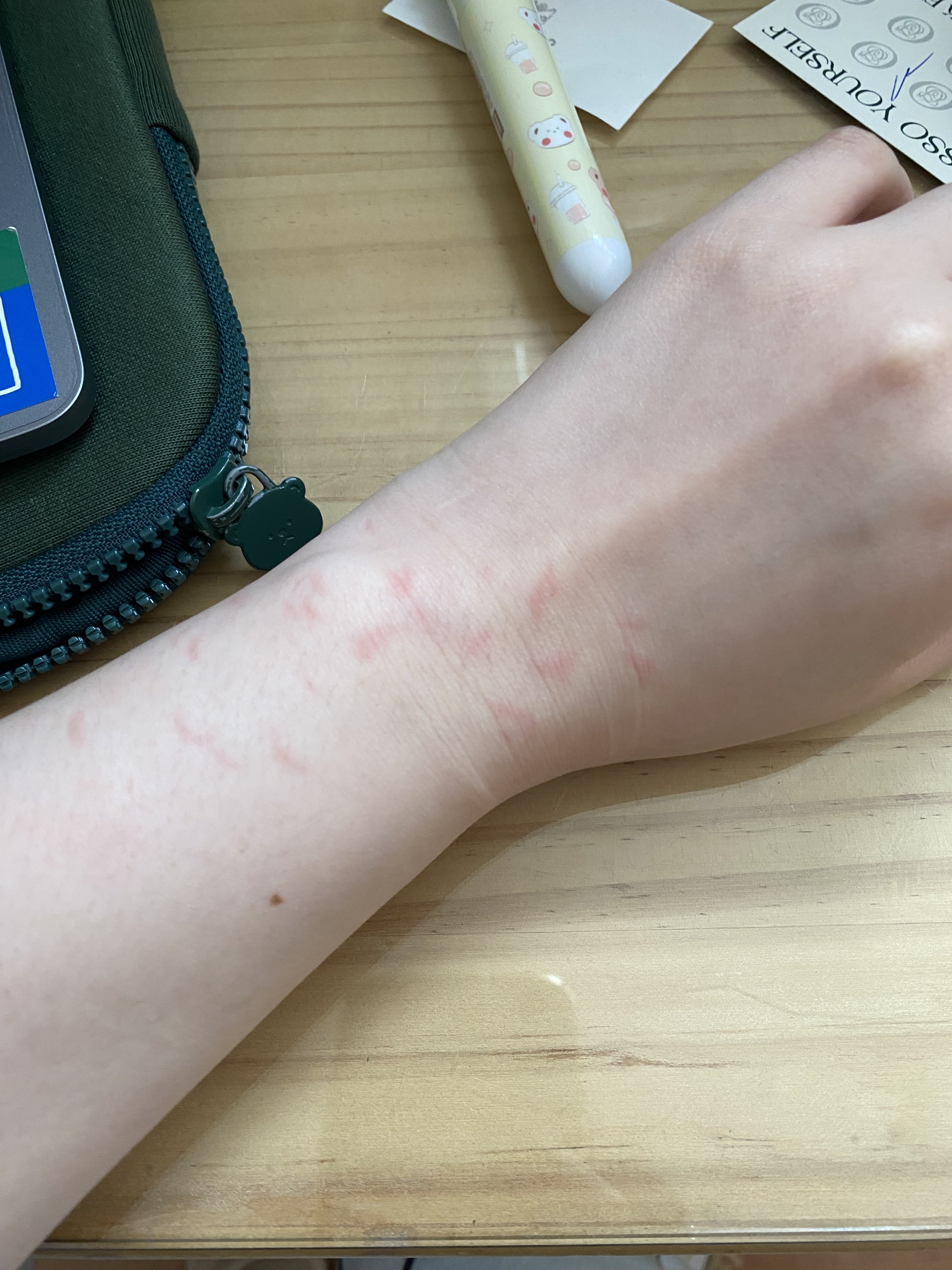 [잡담] 치과치료 별거 아니네 왜그리 무서워함 ㅋ 쫄보들아 | 인스티즈