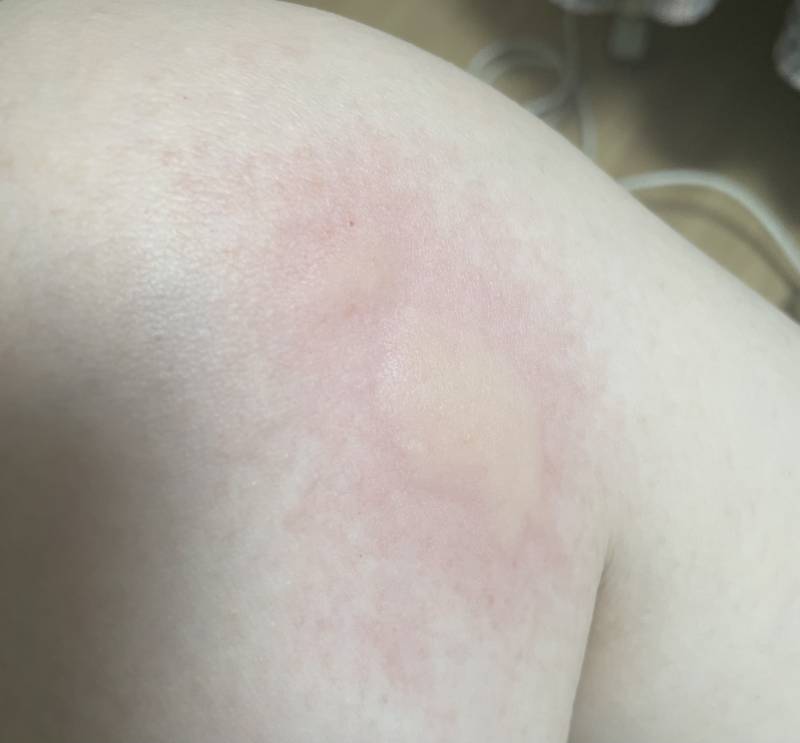 [잡담] 얘들아 밑에 뚫린 침대 사지마라 모기 밥 된다 | 인스티즈