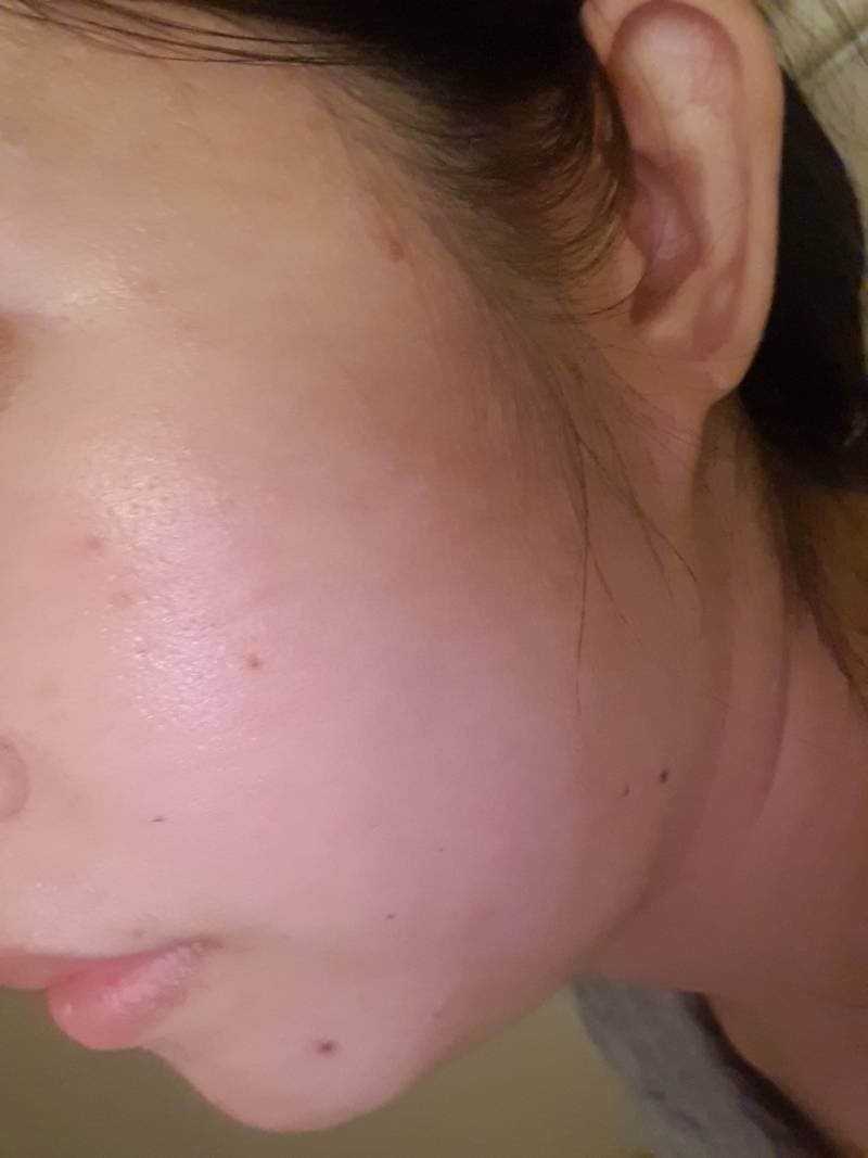 [잡담] 오..예전이랑 비교하니까 피부 좋아진듯 | 인스티즈