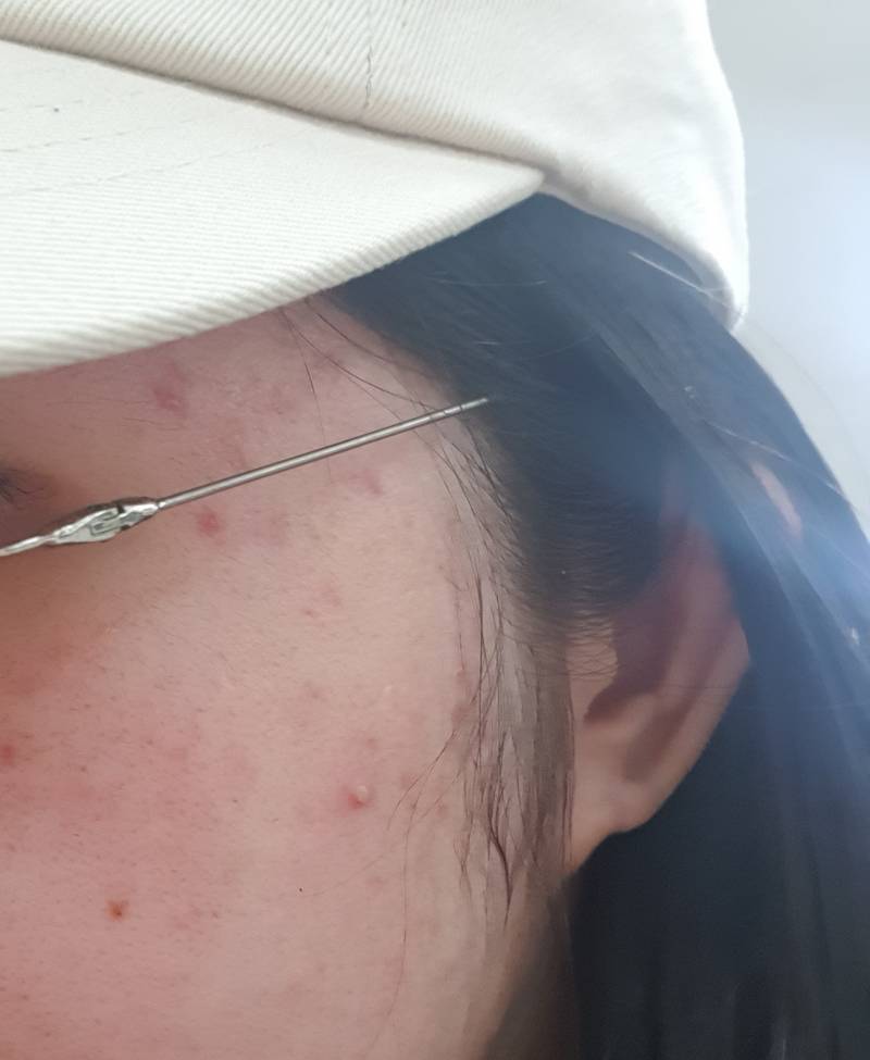 [잡담] 오..예전이랑 비교하니까 피부 좋아진듯 | 인스티즈