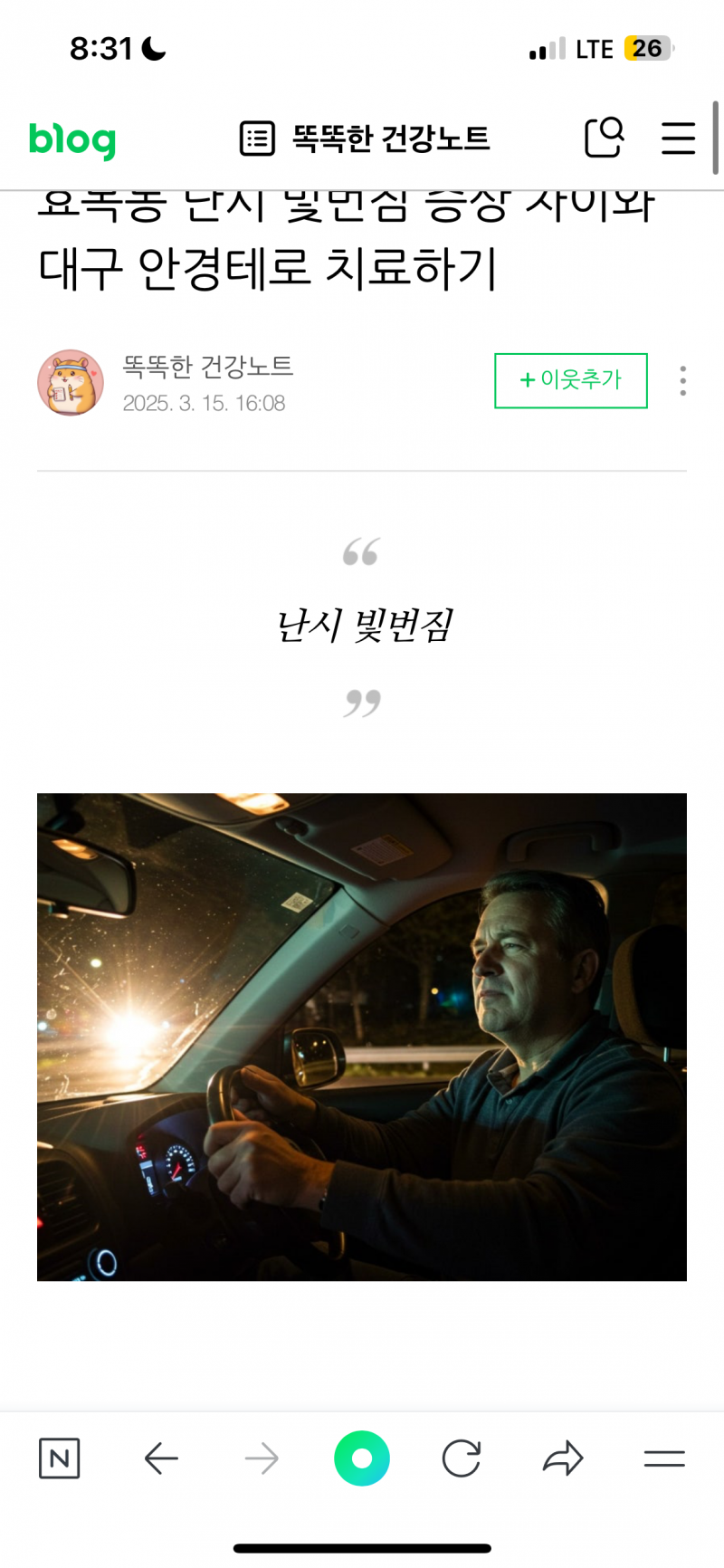 [잡담] 난시 심한 애들아 너희두 빛 이렇게 보여? | 인스티즈
