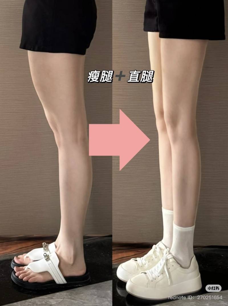 [잡담] 왼쪽다리 나랑 짱똑이다 | 인스티즈