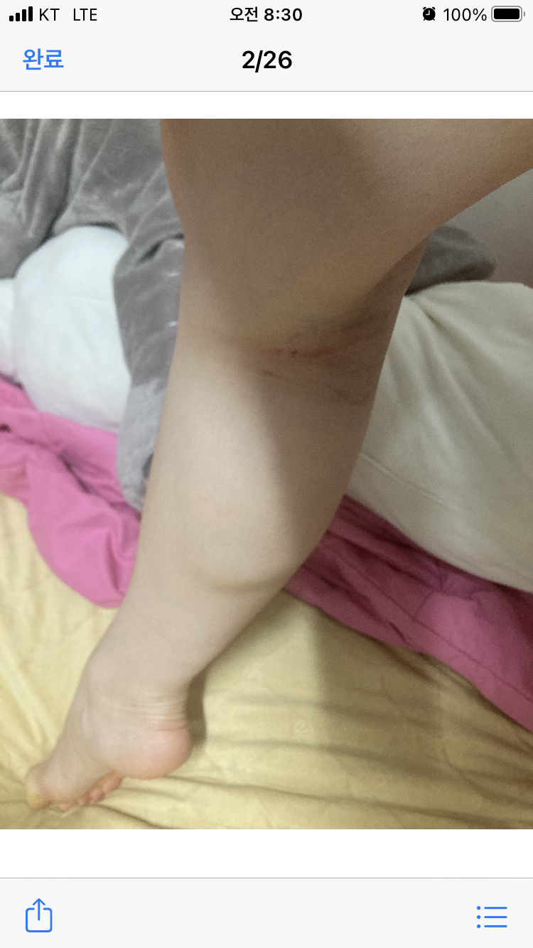 [잡담] 나 근력 운동 하면 몸매가 안예뻐져.. | 인스티즈