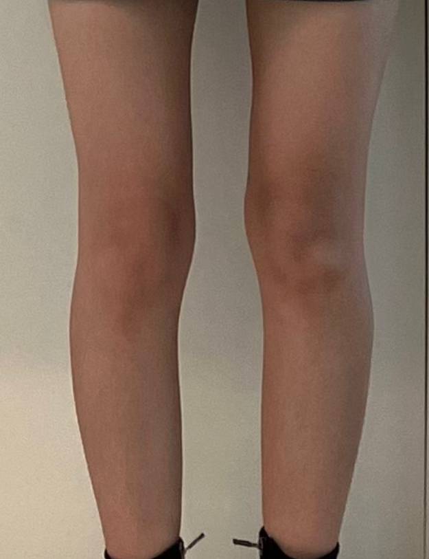 [잡담] 나 진짜 개개개개말라였던 증거 | 인스티즈