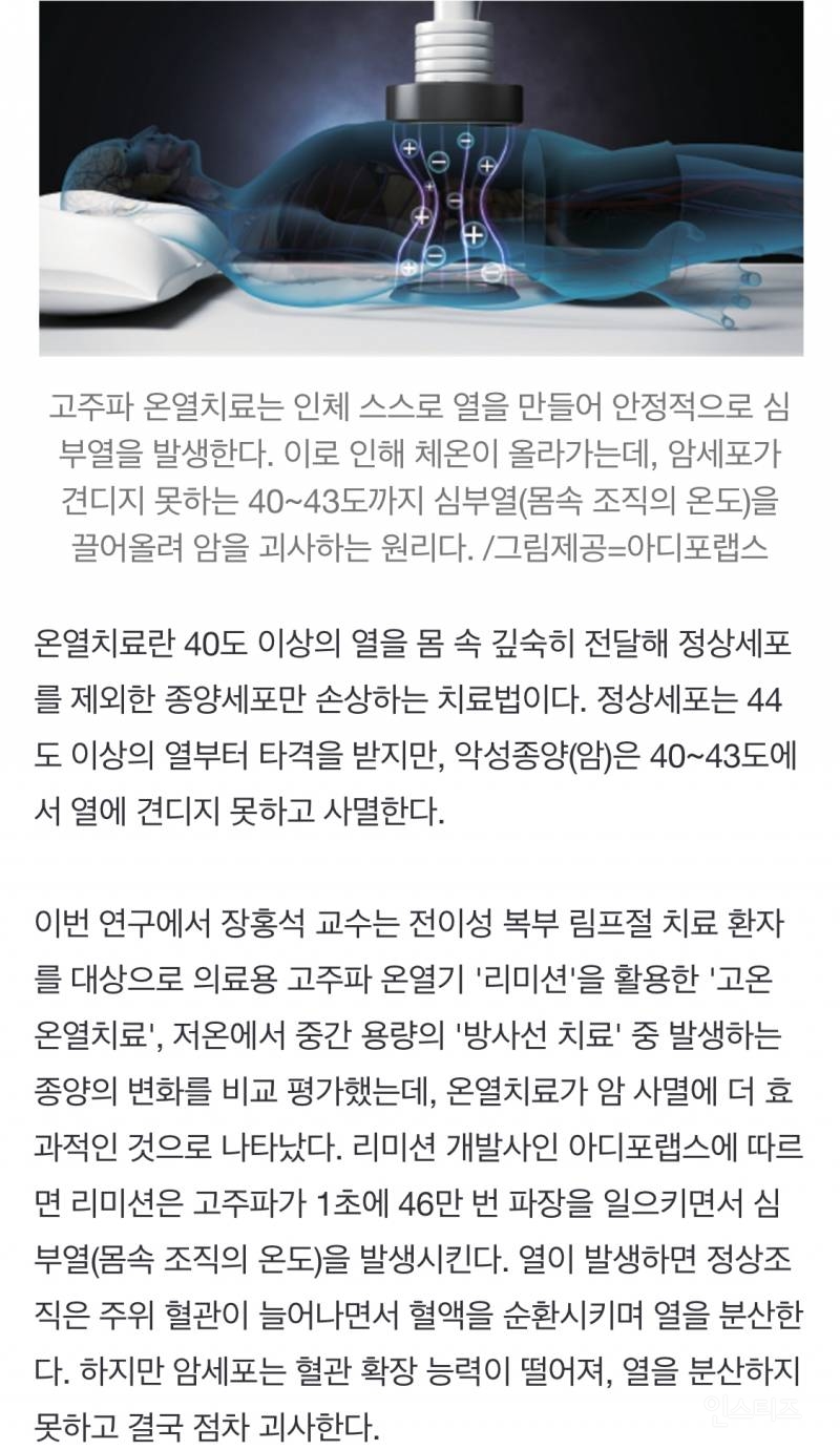 "암이 못 견디는 40~43도로 체온 올려 사멸" 온열치료 효과 국내서 입증 | 인스티즈