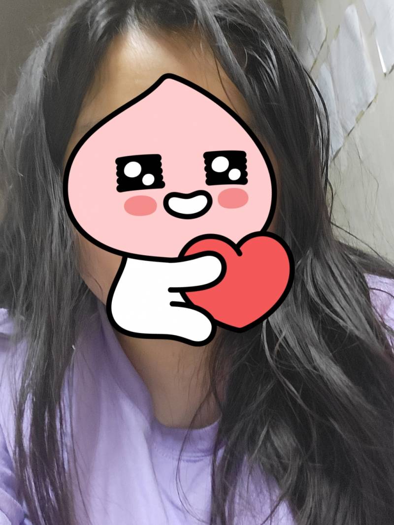 [잡담] 탈모인지봐줘 | 인스티즈