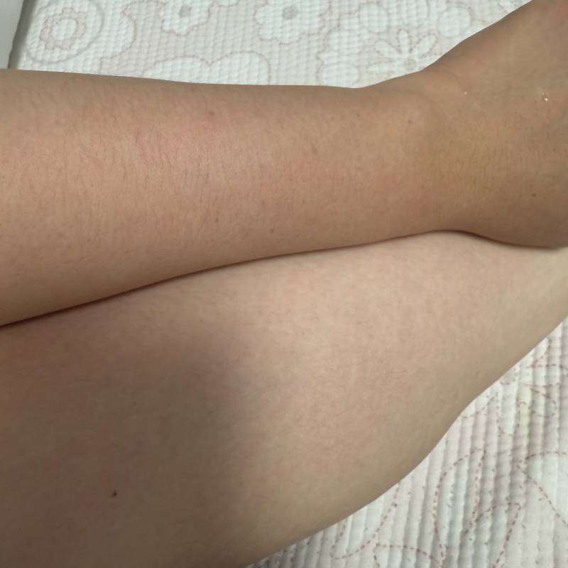 [잡담] 다리랑 팔 보면 진짜 인종이 다름 .. | 인스티즈