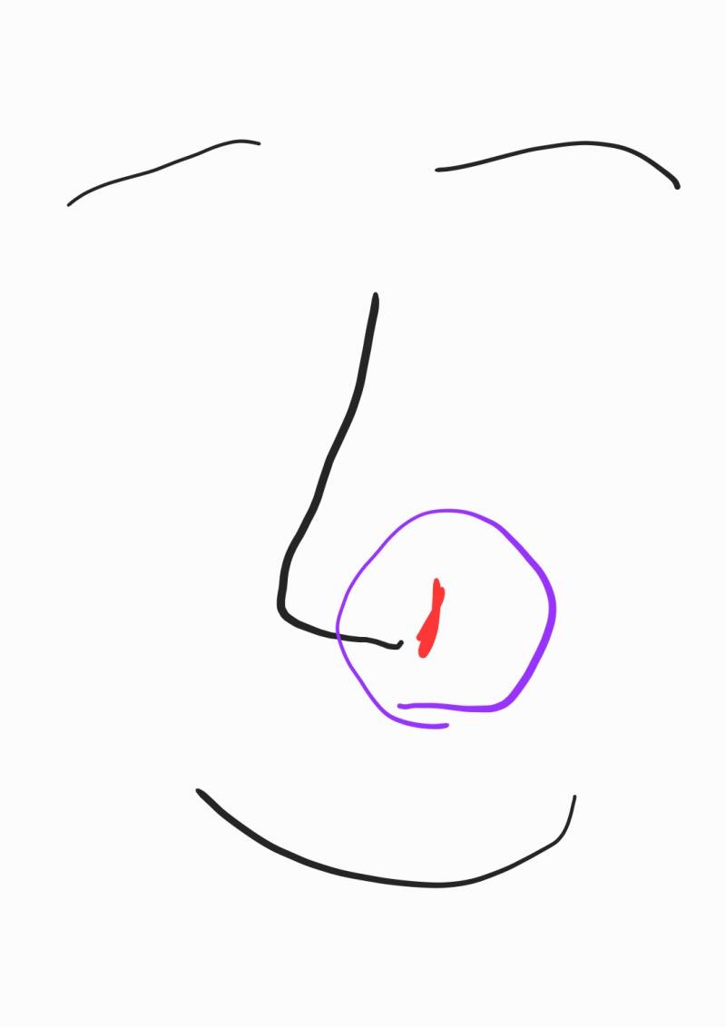 [잡담] 코 옆에 왜 가뭄처럼 갈라지고 아프지ㅠㅠ | 인스티즈