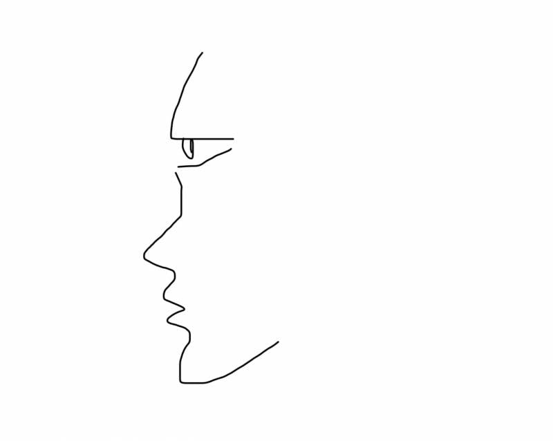 [잡담] 무쌍 지방제거 해본 사람 있어? | 인스티즈