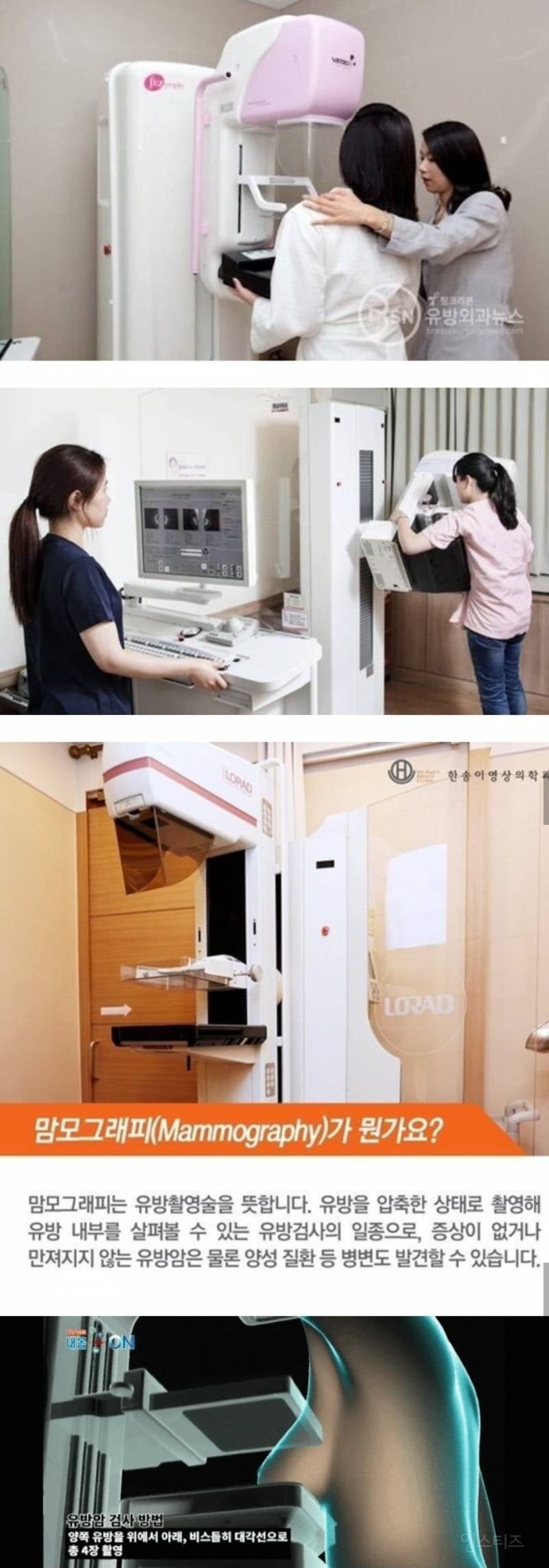 충격)이제껏 간호사가 아니라 방사선사들이 했다는 여성검진.jpg | 인스티즈