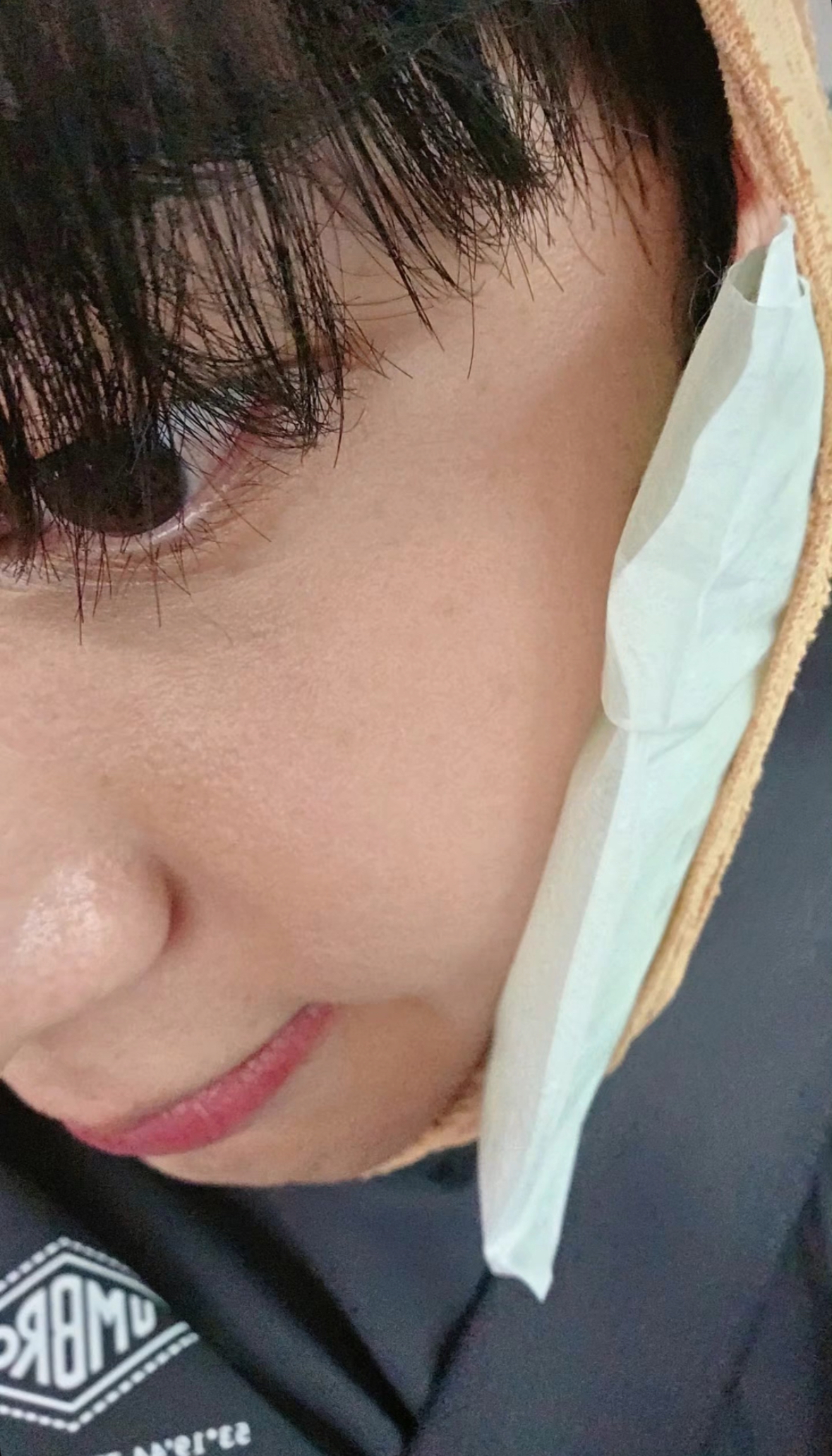 [잡담] 영케이 사랑니 빼고 셀카 올려줬는데 개충격 | 인스티즈
