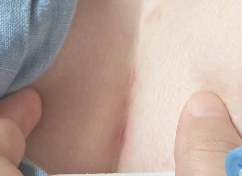 [잡담] 하..이거 가슴골 땀 진짜 어떡하냐...따갑고 간지럽고ㅜ | 인스티즈