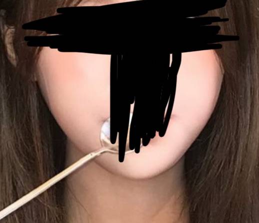 [잡담] 얼굴형 이렇게 되려면 수술 뿐일까 | 인스티즈