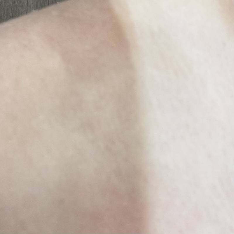 [잡담] 휴양지에서 잘 놀고 심각하게 탔다ㅋㅋㅋㅋㅠㅠ | 인스티즈