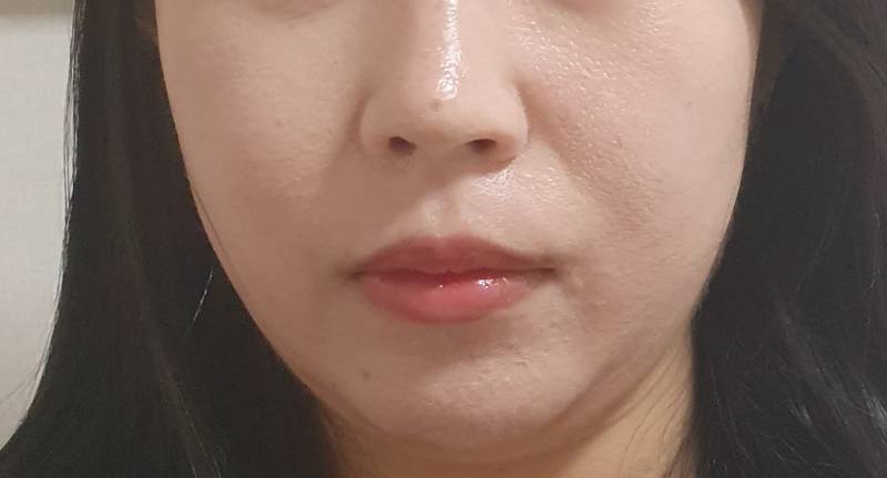 [잡담] 나 이중턱 심해? | 인스티즈