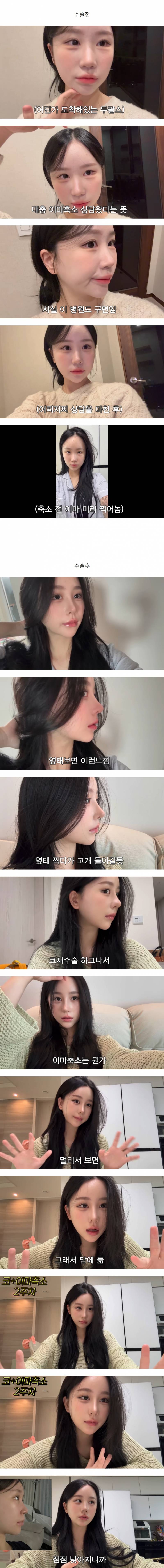 현재 얼굴 다르게 바뀐 조두팔.JPG | 인스티즈