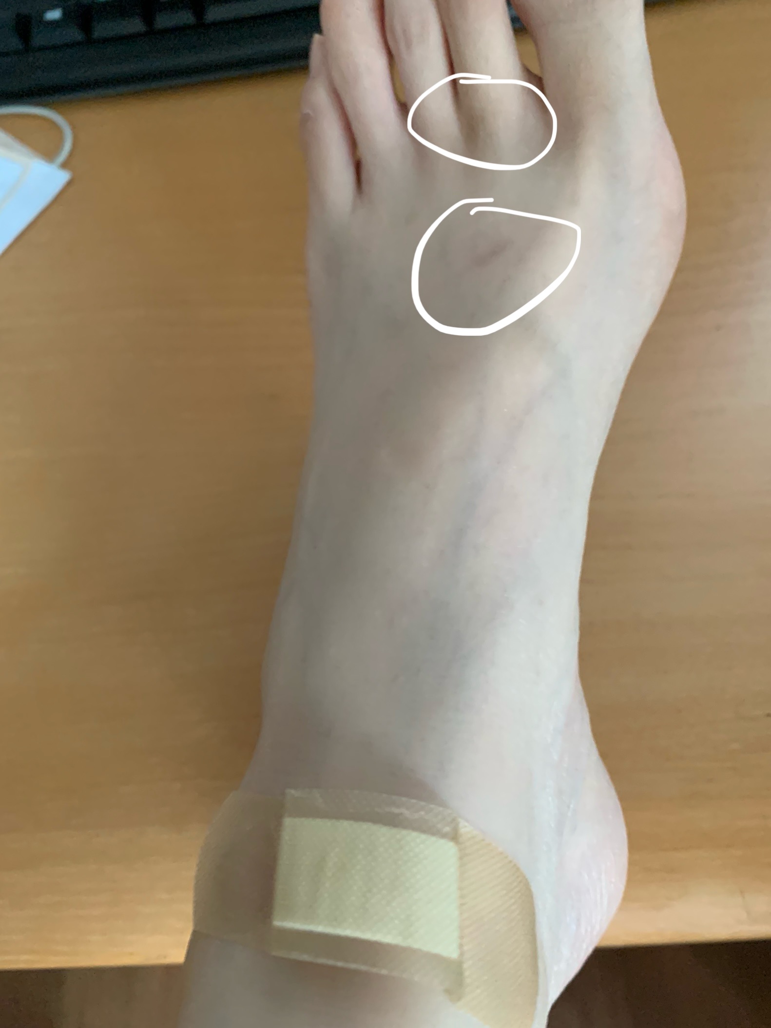 [잡담] 슬리퍼만 신으면 자꾸 발에 상처나는데 어떻게해? | 인스티즈