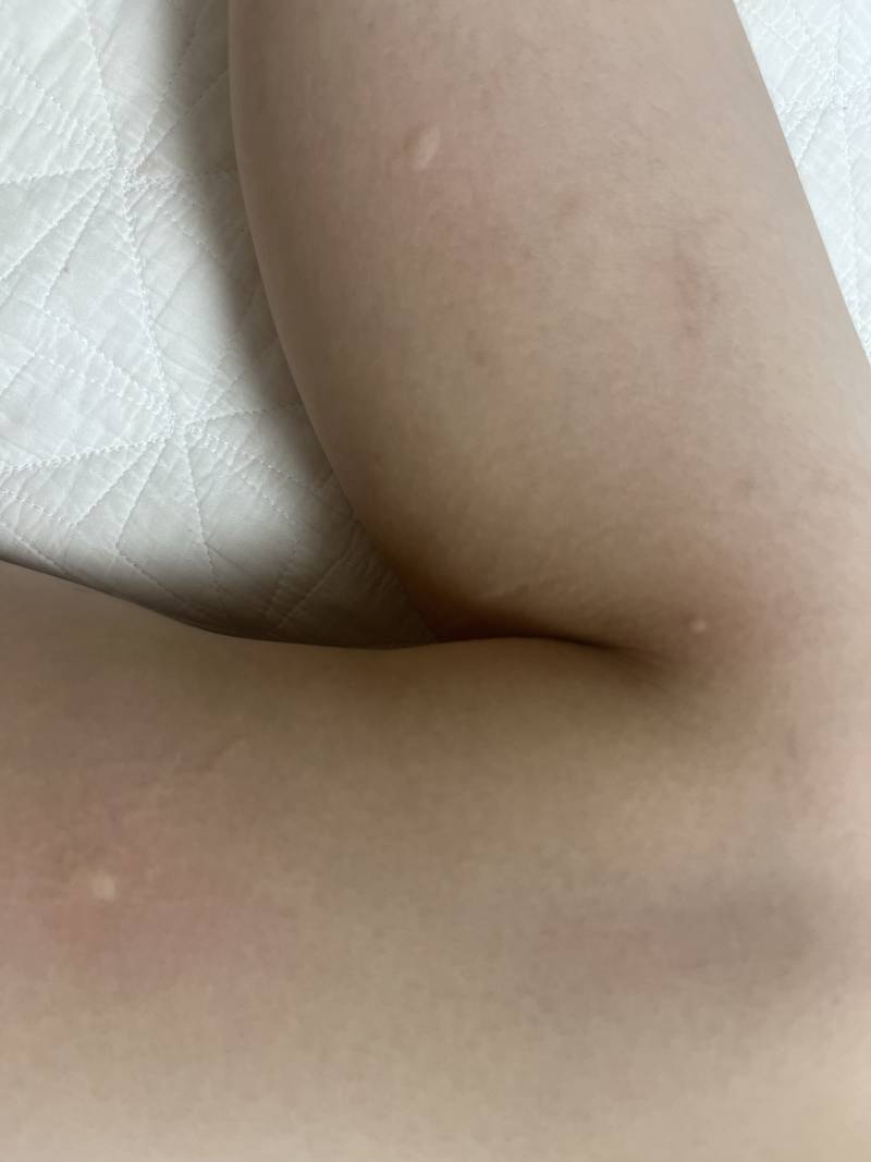 [잡담] 아니 자다가 방금 깼는데 모기 너무한 거 아니냐 | 인스티즈