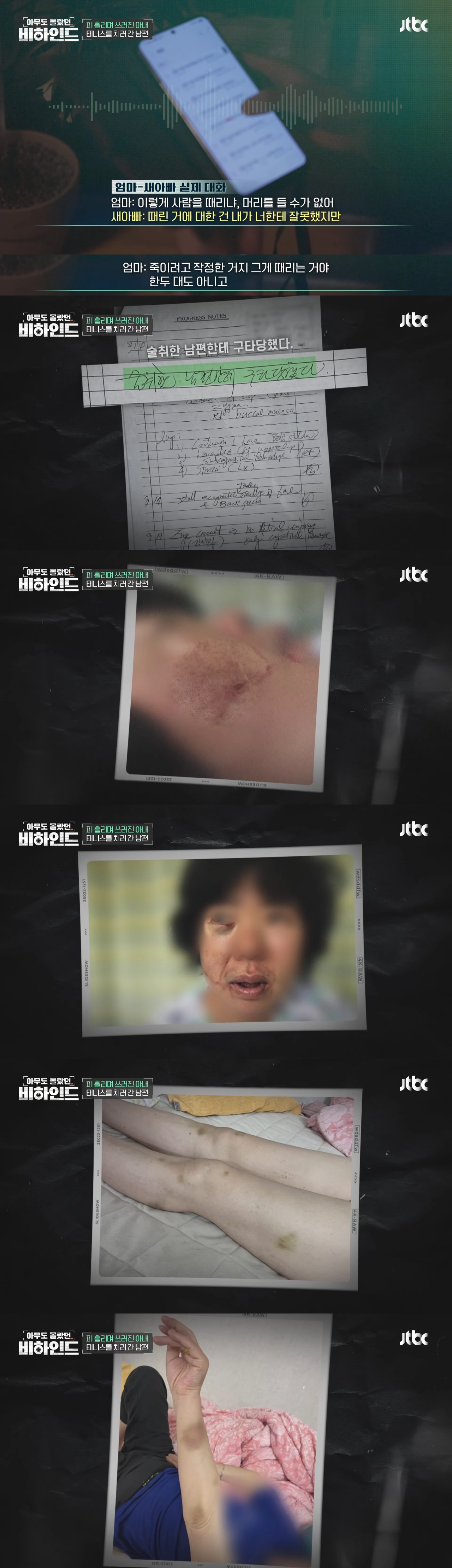 피 흘리며 쓰러진 아내 두고 테니스 치러 간 남편 | 인스티즈