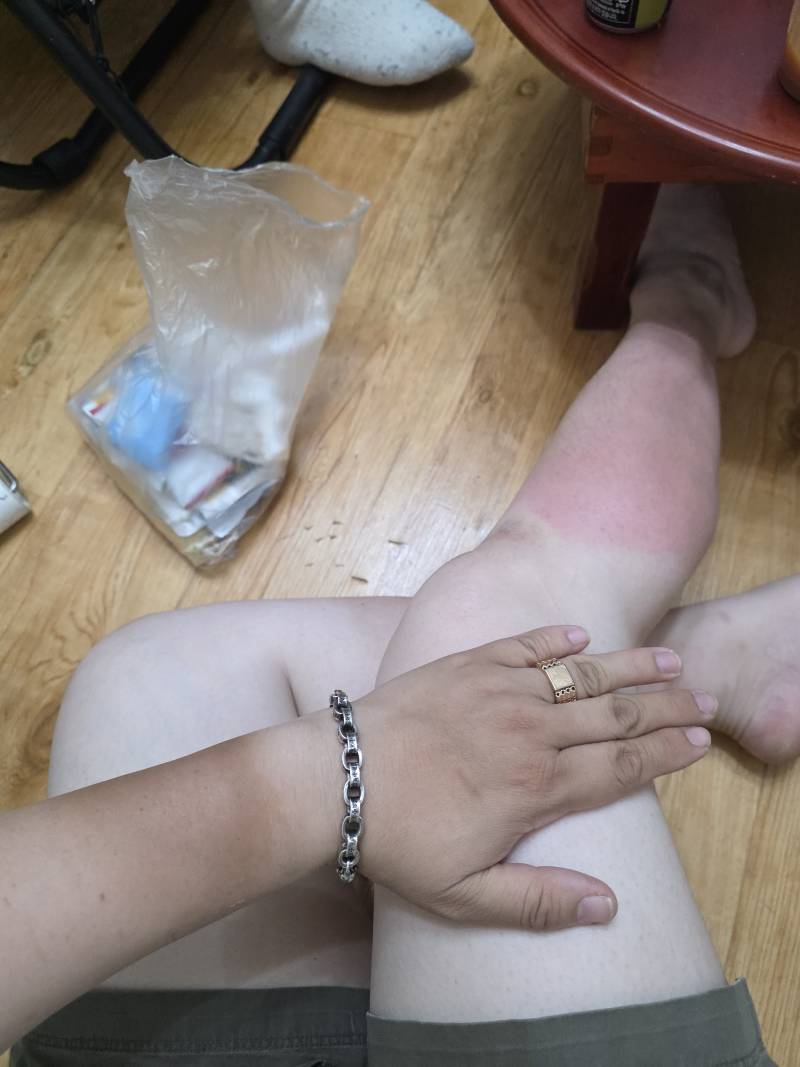 [잡담] 얘들아 내 인종 맞춰 봐 ☝🏼💪🏽🦵🏻🦶🏼 | 인스티즈