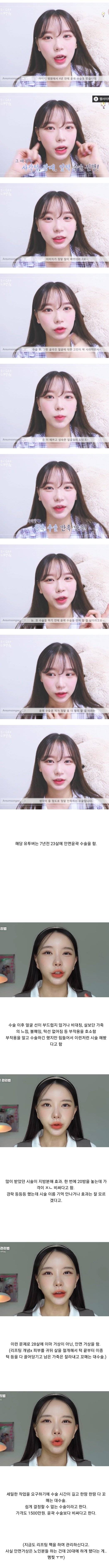안면윤곽 7년 지난 유튜버의 얼굴형 관리법 | 인스티즈