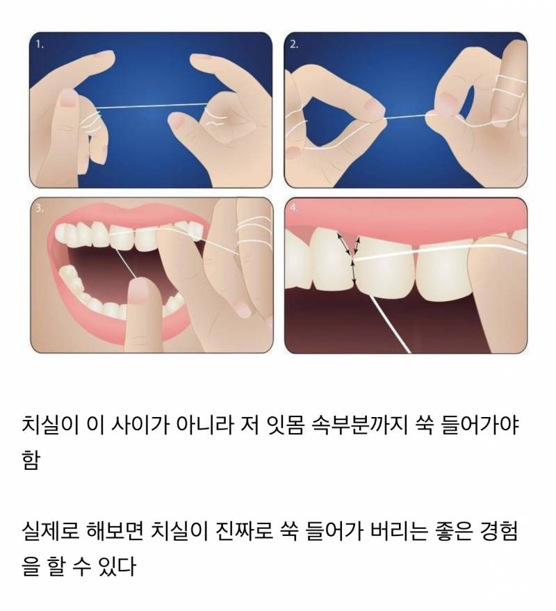 치실질 처음 하는 사람들이 의외로 잘 모를 수 있는 거 | 인스티즈