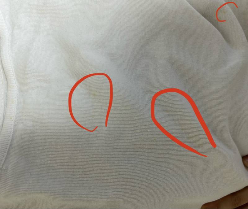 [잡담] 너네 흰티셔츠 뒷면에 이런 얼룩 있음 버릴 거임? | 인스티즈