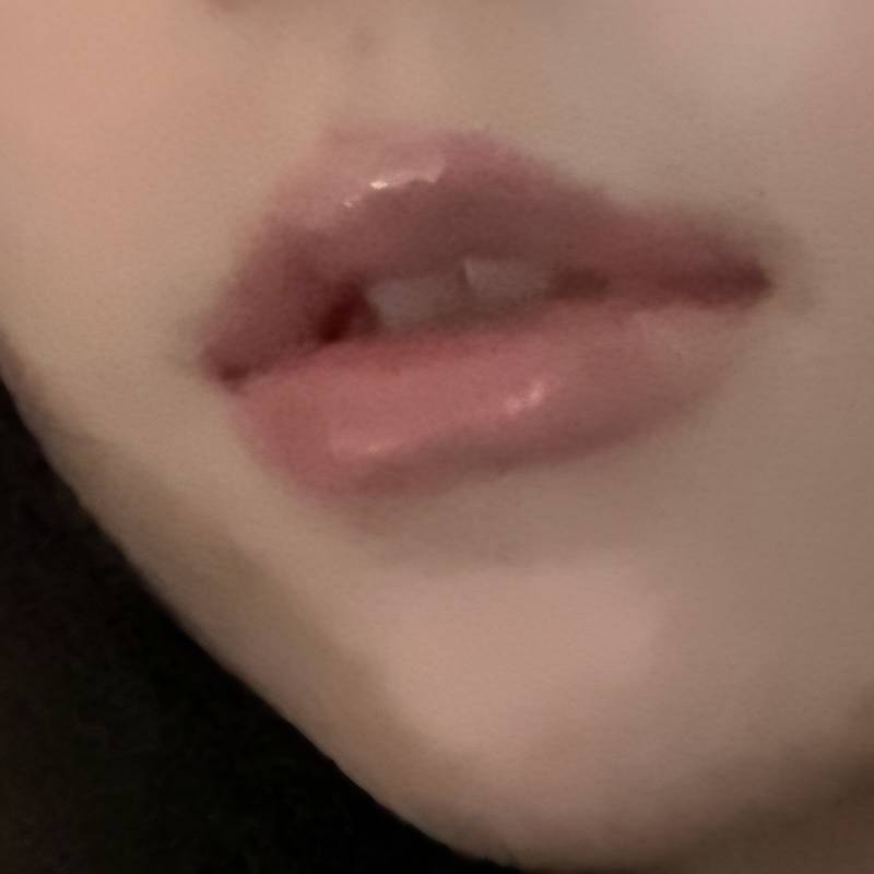 [잡담] 이런 토끼앞니 교정해야하는고닝 | 인스티즈