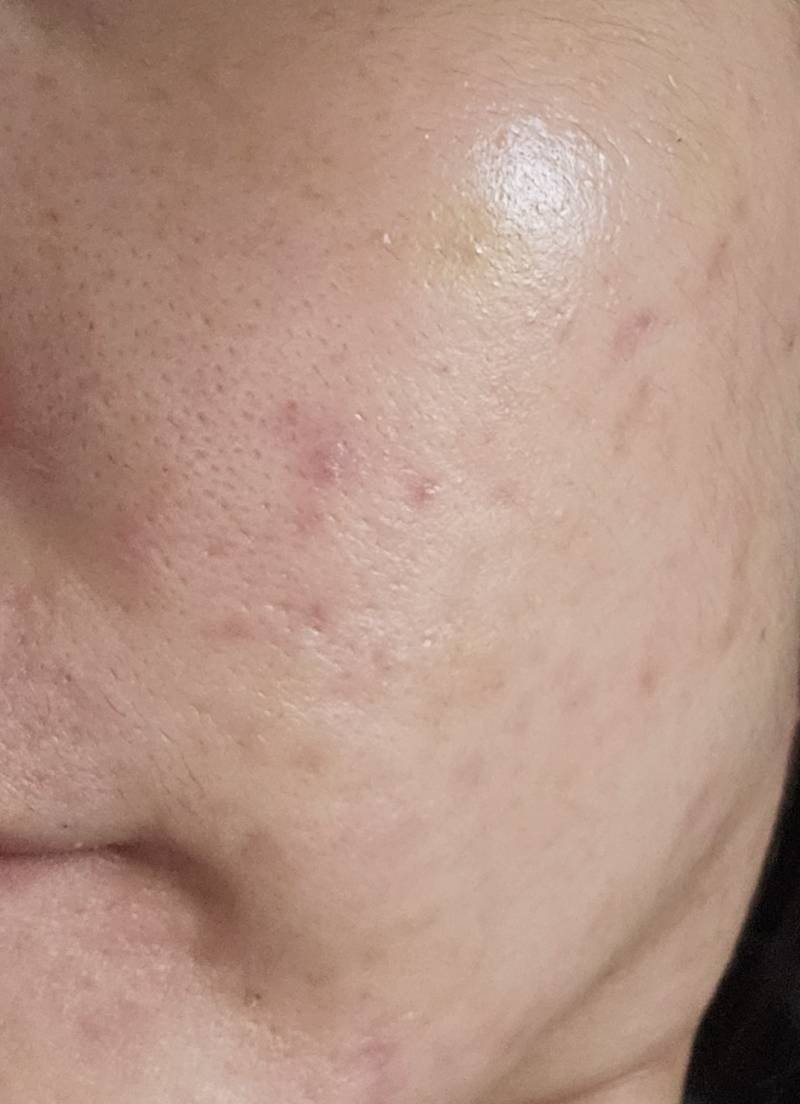 [잡담] 나 피부 많이 좋아졌다🥺😭 | 인스티즈