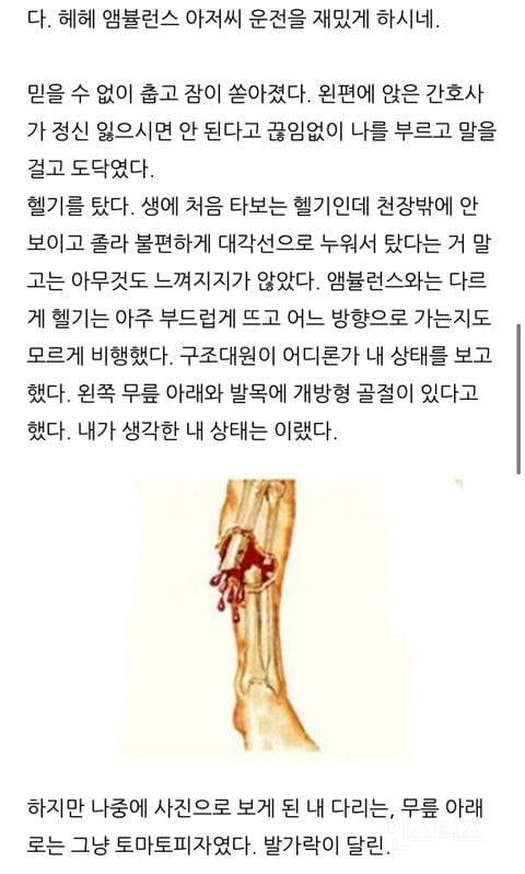 자전거 유튜버 다리 절단 교통사고 당시 글과 근황 | 인스티즈