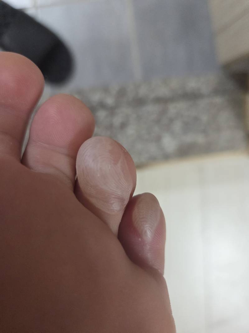 [잡담] 발가락이 하나 더 생긴줄^^ | 인스티즈