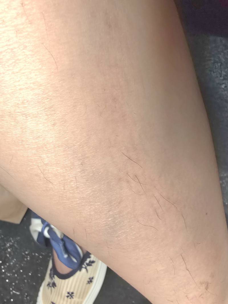 [잡담] (사진주의) 나만큼 다리털 많은 여자 있어?.....에혀 | 인스티즈