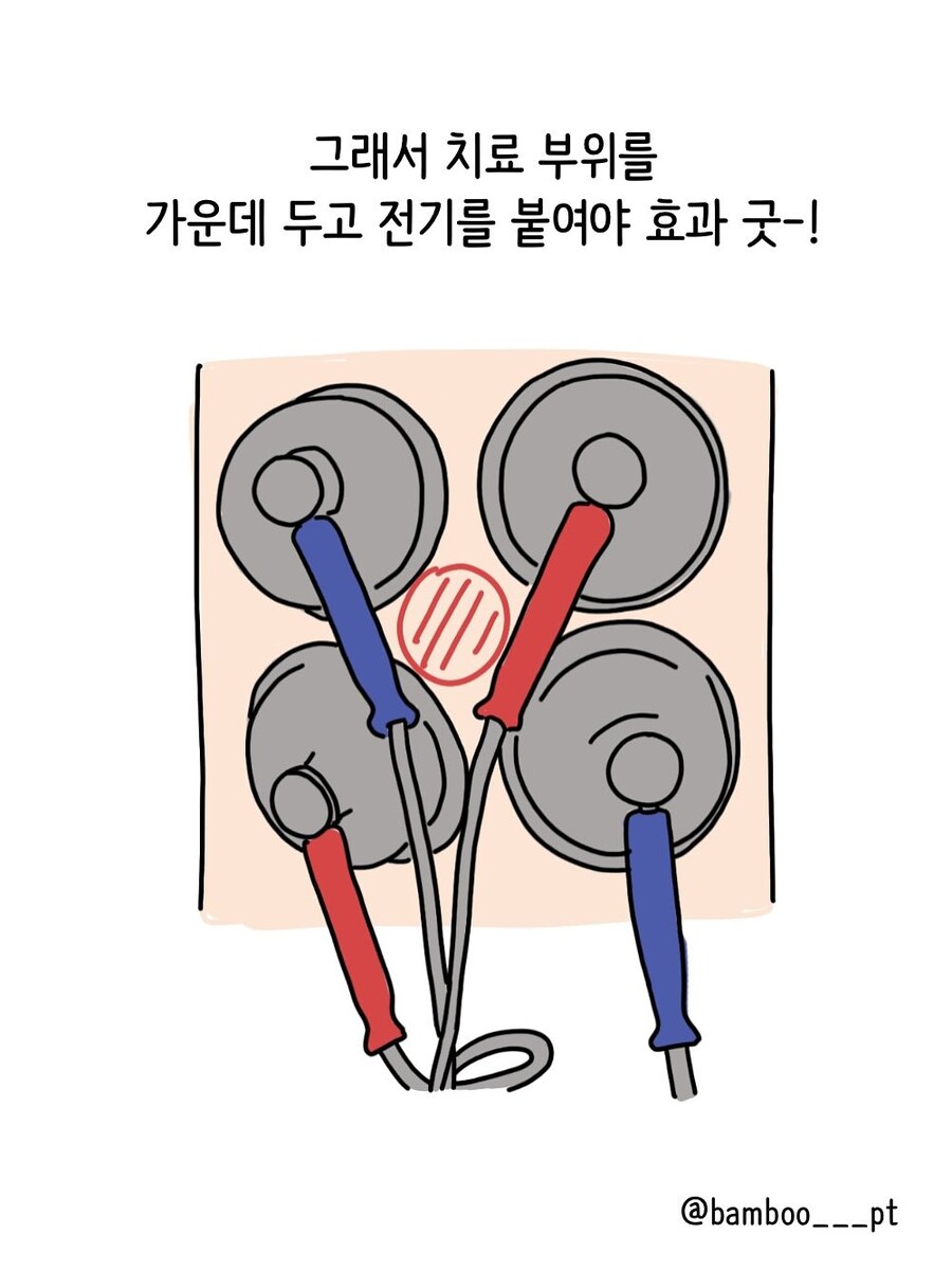 병원에서 물리치료받을때 명심해야 할 것 | 인스티즈