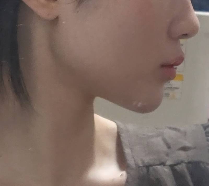 [잡담] 사각턱같음? | 인스티즈