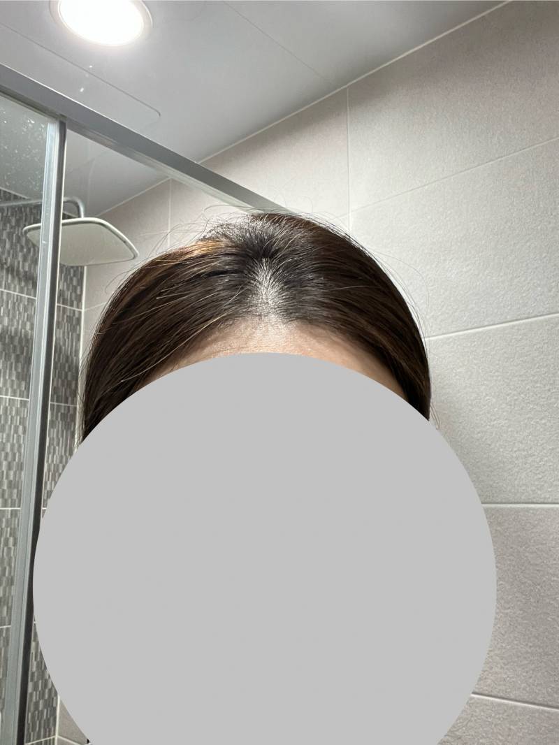 [잡담] 아 나 탈모인가ㅠㅠㅠ | 인스티즈