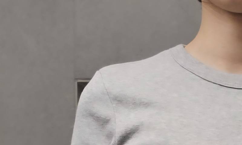 [잡담] 나 승모 있는편인가 미친 날씨라 머리 묶었더니 신경쓰임 | 인스티즈