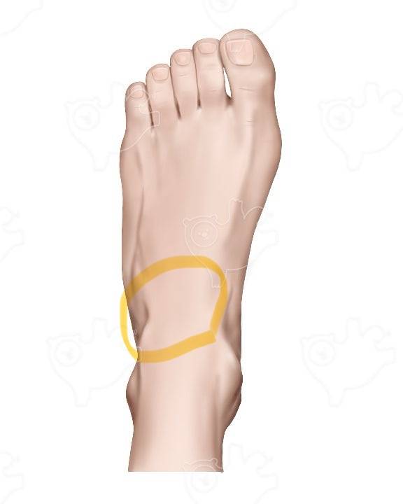 [잡담] 러닝 하고 나서 이 부위가 아픈데 골절인가? | 인스티즈